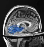 Differential spatial computations in ventral and lateral face-selective regions are scaffolded by structural connections